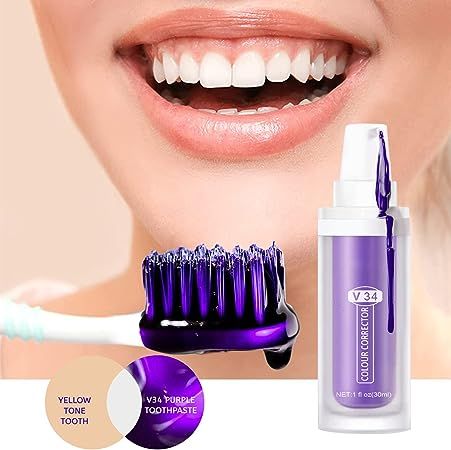 Glorysmile: La solution ultime pour vos dents